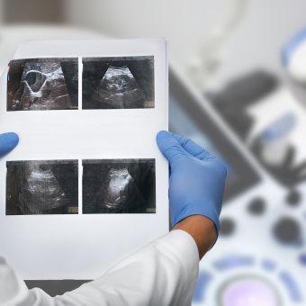 Médico con guantes azules sosteniendo resultados de un ultrasonido de vesícula biliar